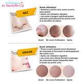 Comment faire disparaître les points noirs ? MASQUE NOIR