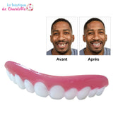 Retrouver un sourire parfait PLACAGE SOURIRE PARFAIT