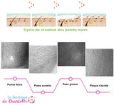 Faire disparaître les points noirs ASPIRATEUR POINTS NOIRS